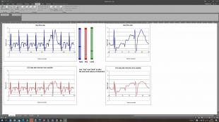 Simulation of distortion, ECG signal